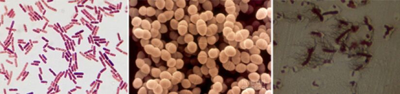Escherichia Coli, Fecal Enterococcus жана Proteus өнөкөт бактериялык проптатитинин негизги себеп сепативдик агенттери